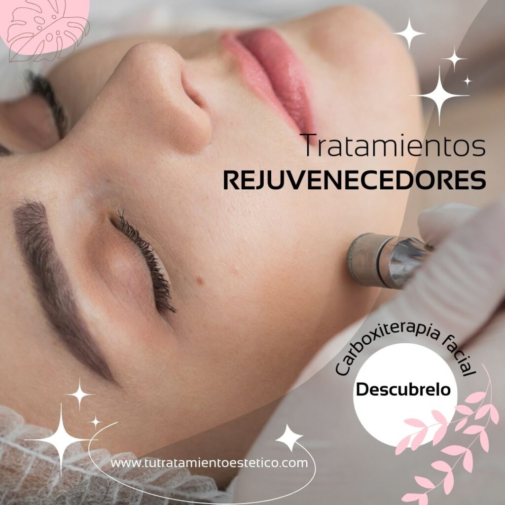 Tratamiento Carboxiterapia Facial