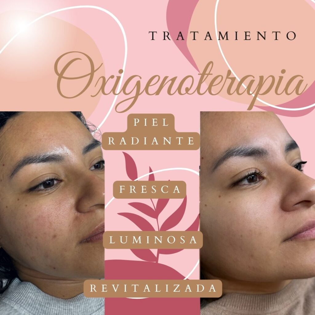 Oxigenoterapia