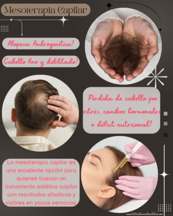 Mesoterapia Capilar
