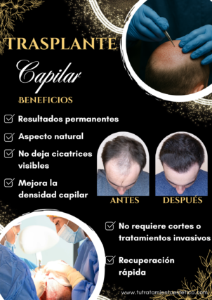 Trasplante Capilar