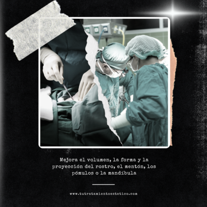 Implantes Faciales