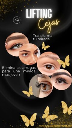 Lifting de Cejas