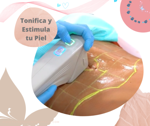 Tratamientos para Reafirmar la Piel